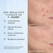 Image divisée montrant l’application de la mousse à côté d’une liste d’avantages, incluant Élimine le maquillage, la protection solaire et les impuretés et Purifie et nourrit la peau.