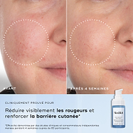 Gros plans côte à côte d’une joue présentant des rougeurs et des irrégularités de texture, étiquetés Avant et Après 4 semaines. Le texte en dessous indique Cliniquement prouvé pour réduire visiblement les rougeurs et améliorer la santé de la barrière cutanée.