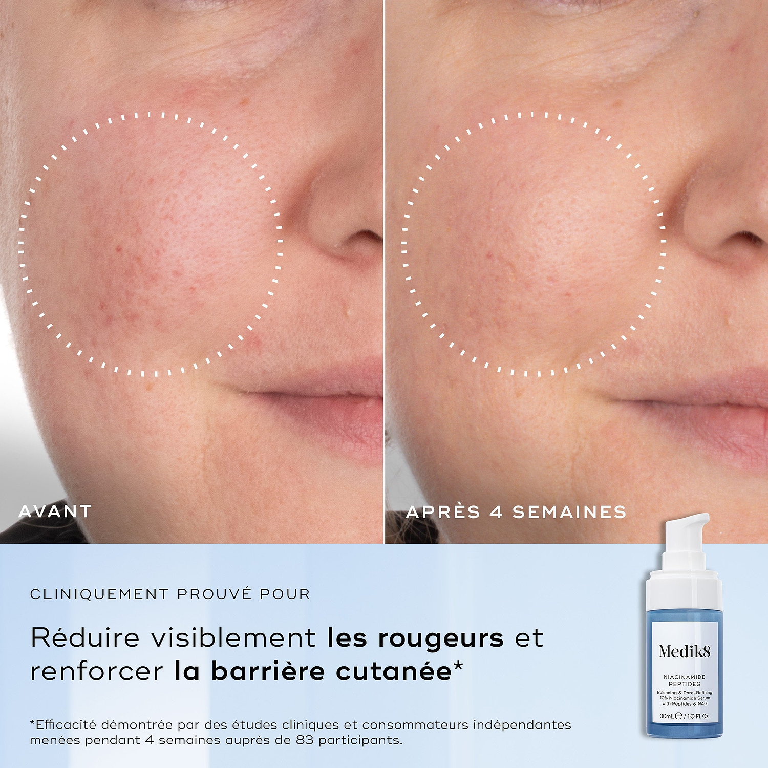 Gros plans côte à côte d’une joue présentant des rougeurs et des irrégularités de texture, étiquetés Avant et Après 4 semaines. Le texte en dessous indique Cliniquement prouvé pour réduire visiblement les rougeurs et améliorer la santé de la barrière cutanée.