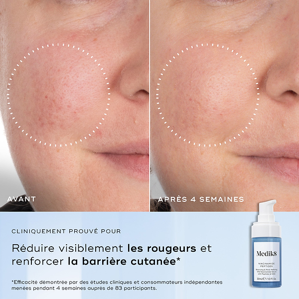 Gros plans côte à côte d’une joue présentant des rougeurs et des irrégularités de texture, étiquetés Avant et Après 4 semaines. Le texte en dessous indique Cliniquement prouvé pour réduire visiblement les rougeurs et améliorer la santé de la barrière cutanée.
