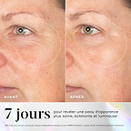 Images avant-après de la zone du regard montrant une amélioration de la vitalité et de la luminosité de la peau après 7 jours d'utilisation du Medik8 Exo-PDRN Prismatic+.