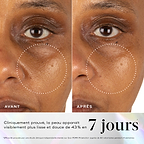 Gros plan avant-après de la joue d'un participant, avec des cercles pointillés soulignant une texture de peau visiblement plus lisse. Le texte inférieur sur fond holographique indique : « Prouvé cliniquement pour améliorer visiblement le grain de peau et la douceur de 43 % en 7 jours. » Une note de bas de page confirme que cela a été prouvé via une étude clinique indépendante sur l'Exo-PDRN Prismatic+ menée sur 60 volontaires pendant 4 semaines.