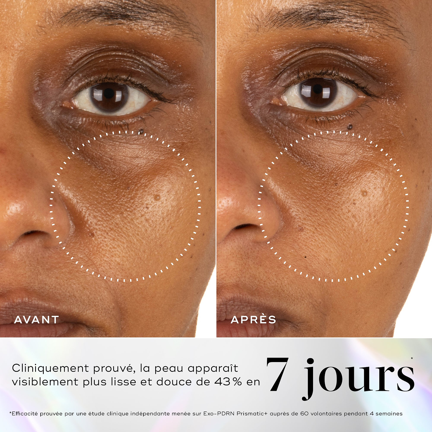 Gros plan avant-après de la joue d'un participant, avec des cercles pointillés soulignant une texture de peau visiblement plus lisse. Le texte inférieur sur fond holographique indique : « Prouvé cliniquement pour améliorer visiblement le grain de peau et la douceur de 43 % en 7 jours. » Une note de bas de page confirme que cela a été prouvé via une étude clinique indépendante sur l'Exo-PDRN Prismatic+ menée sur 60 volontaires pendant 4 semaines.