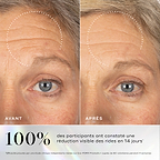 Images avant-après montrant des rides visibles sur le contour des yeux, avec une amélioration soulignée après l'utilisation du sérum Medik8 Exo-PDRN Prismatic+.