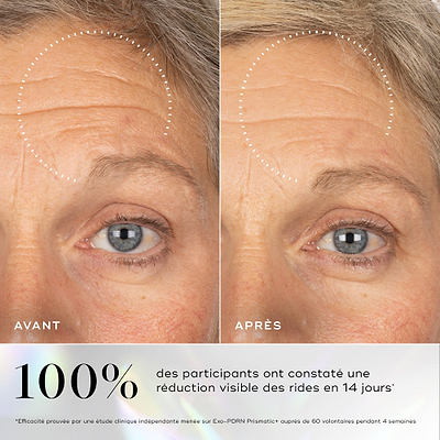 Images avant-après montrant des rides visibles sur le contour des yeux, avec une amélioration soulignée après l'utilisation du sérum Medik8 Exo-PDRN Prismatic+.