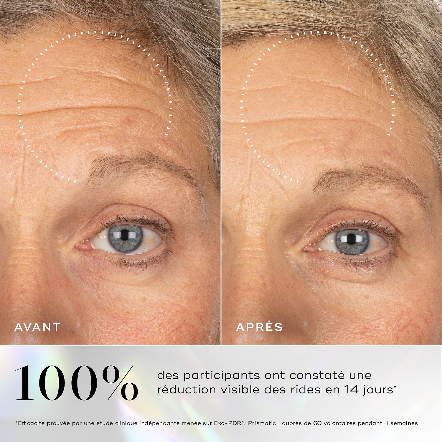 Images avant-après montrant des rides visibles sur le contour des yeux, avec une amélioration soulignée après l'utilisation du sérum Medik8 Exo-PDRN Prismatic+.