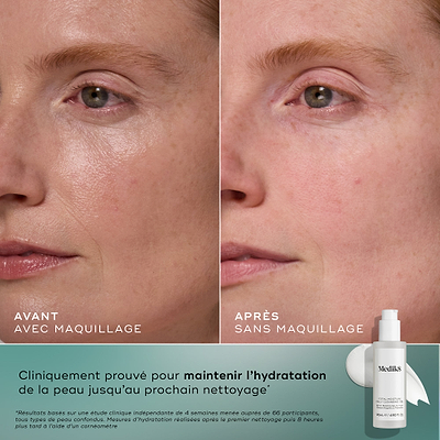 Total Moisture Daily Cleansing Gel