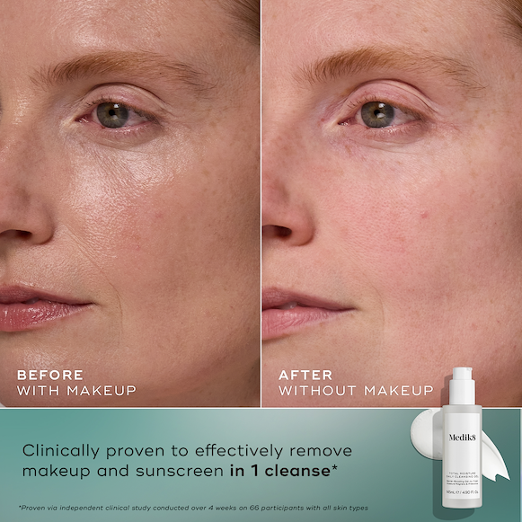 Total Moisture Daily Cleansing Gel-hover-1