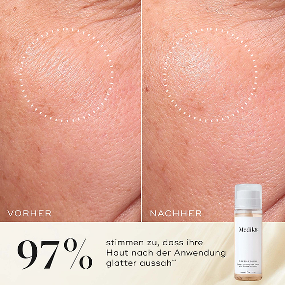 Nahaufnahme der Wange einer Teilnehmerin vor und nach der Anwendung, die eine glattere Textur und ein gleichmäßigeres Erscheinungsbild zeigt. Die Medik8 Press & Glow-Tonikflasche ist in der Ecke zu sehen. Der Text hebt hervor: „97 % stimmen zu, dass ihre Haut nach der Anwendung glatter aussah.“-hover-18