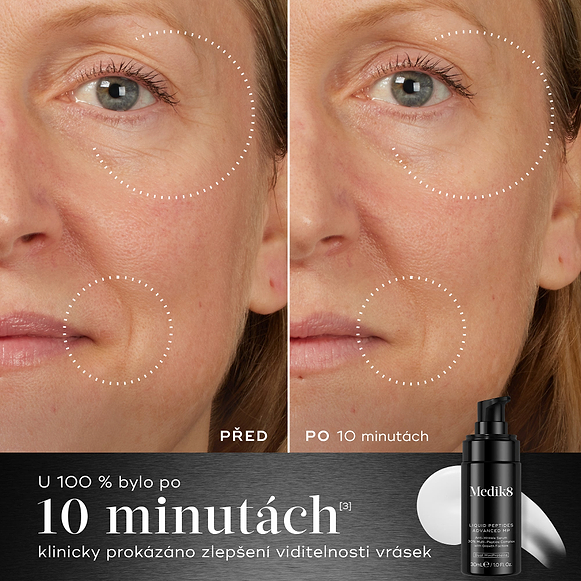 10 minuty – Srovnání „před a po“ obličeje účastníka zobrazené vedle lahvičky Medik8 Liquid Peptides Advanced MP ukazuje snížení vrásek v oblasti očí a úst. Text zdůrazňuje, že 100 % účastníků vykázalo klinické zlepšení viditelných vrásek během 10 minut.-hover-4