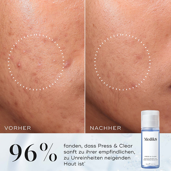 Press & Clear™ hover