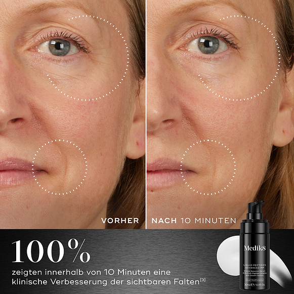 Ein Vorher-Nachher-Vergleich des Gesichts eines Teilnehmers wird neben der Flasche des Medik8 Liquid Peptides Advanced MP gezeigt. Die Bilder demonstrieren eine Verringerung der Falten um Augen und Mund. Der Text hebt hervor, dass 100 % eine klinische Verbesserung sichtbarer Falten innerhalb von 10 Minuten zeigten.-hover-4