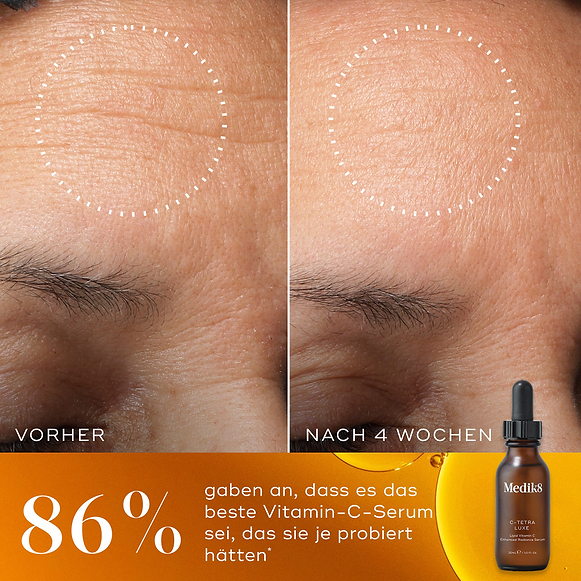 Vorher-nachher-Vergleich der Stirn eines Teilnehmers über 4 Wochen, wobei ein weißer, gepunkteter Kreis eine sichtbare Reduktion von feinen Linien und Falten hervorhebt. Am unteren Bildrand ist ein warmes orange-goldenes Hintergrundmotiv mit einer Medik8 C-Tetra Luxe Serumflasche und dem Hinweis 86% gaben an, dass es das beste Vitamin-C-Serum war, das sie je ausprobiert haben zu sehen.-hover-4