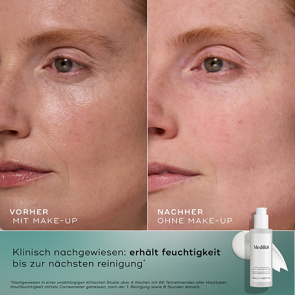 Total Moisture Daily Cleansing Gel-hover-1