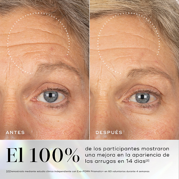 Comparación del antes y después de la frente y el área de los ojos de una persona, con un círculo punteado que resalta una reducción visible de las arrugas en la frente. Debajo, un texto grande indica que el 100% de los participantes notó una reducción visible de las arrugas en 14 días.-hover-1
