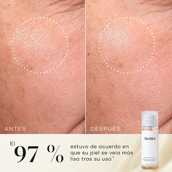Primer plano de antes y después de la piel de la mejilla de un participante, mostrando una textura más suave y una apariencia más uniforme. La botella del tónico Medik8 Press & Glow aparece en una esquina. El texto destaca que el 97 % está de acuerdo en que su piel se veía más suave después de usarlo.-hover-13