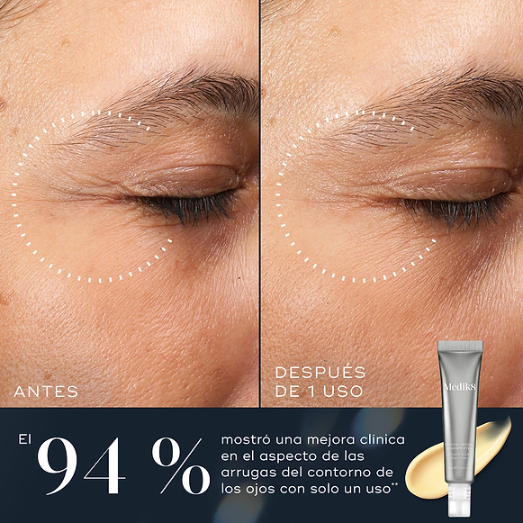 Comparación de antes y después del área de los ojos de una persona que muestra una mejora en la apariencia de las arrugas alrededor de los ojos tras solo un uso. Debajo de las imágenes, el texto indica: «El 94 % mostró una mejora clínica en la apariencia de las arrugas alrededor de los ojos con solo 1 uso».
-hover-6