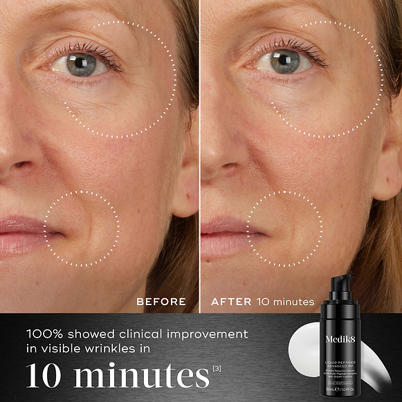 Before and after 10 minutes comparison shows the eye and smile area of a person, illustrating a reduction in the look wrinkles. Below the images, text states "Clinically proven to improve the look of deep-set wrinkles in 8 weeks"-hover-5