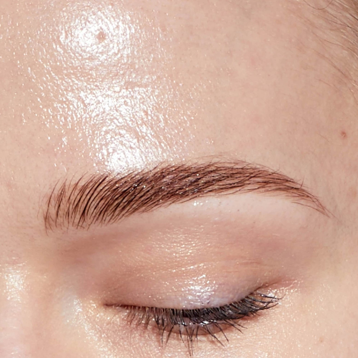 Oily and Congested Skin: