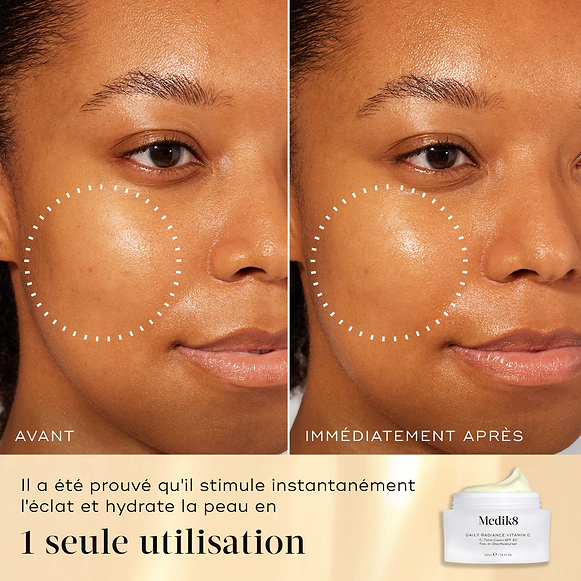 Comparaison avant-après du visage d’un modèle montrant les résultats du Daily Radiance Vitamin C. Des cercles blancs en pointillés mettent en évidence une zone spécifique de la joue pour montrer un gain visible d’éclat et d’hydratation immédiatement après une utilisation