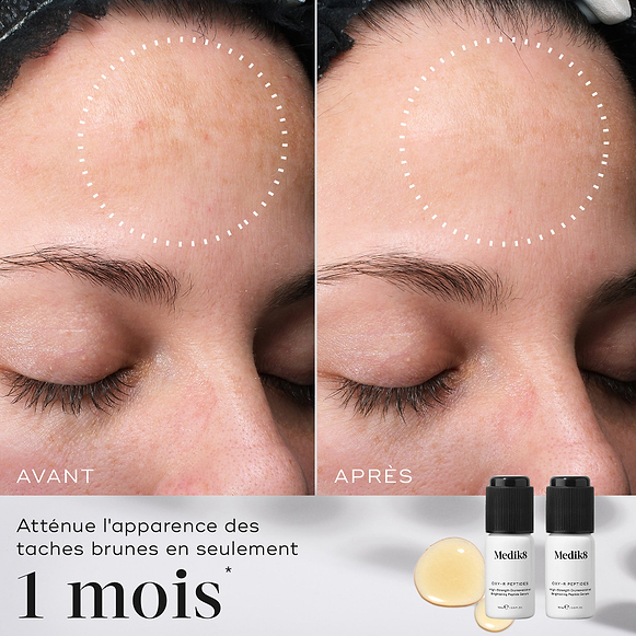 Une comparaison avant-après du front d’une personne montre une atténuation des taches sombres. Des cercles blancs pointillés mettent en évidence les zones modifiées. Sous les images, le texte indique : Atténue l’apparence des taches sombres en seulement 1 mois.-hover-6