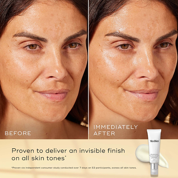 Before-and-after skin comparison of a woman's face, showing a matte finish on the left and a glowing, hydrated finish on the right. A tube of Medik8 advanced day ultimate protect cream is shown in the bottom right corner on a beige background with text highlighting its invisible finish.-hover-12