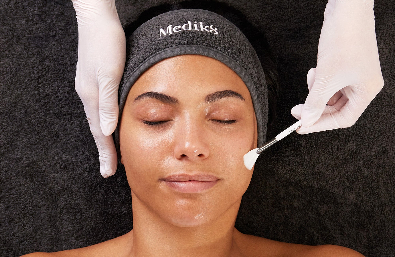 After Chemical Peels