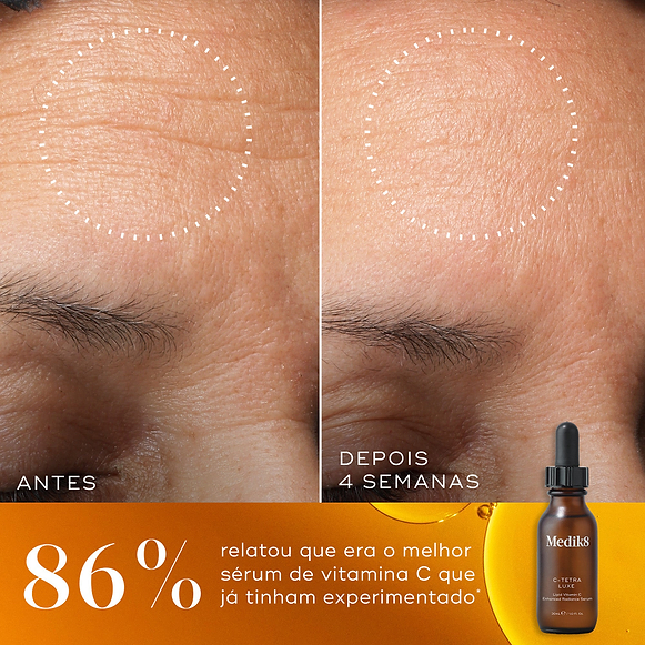 Comparação de antes e depois de rugas na testa ao longo de 4 semanas, com um círculo pontilhado destacando uma pele visivelmente mais suave. Abaixo, ao lado de um frasco de C-Tetra Luxe, o texto afirma que 86% relatou que este era o melhor sérum de vitamina C que já tinham experimentado.-hover-17