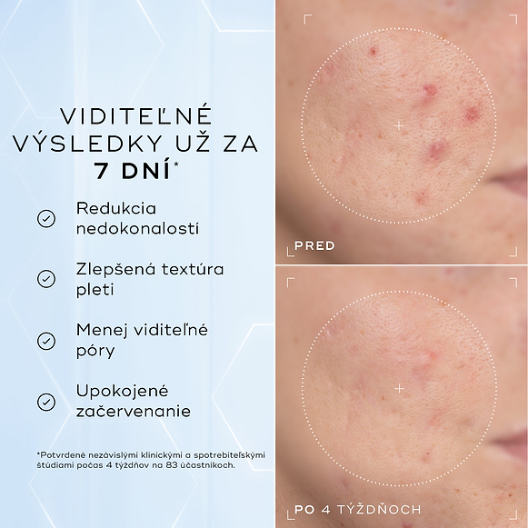 Porovnanie detailných záberov na líce pred aplikáciou a po 4 týždňoch zobrazuje viditeľné zmiernenie začervenania a nedokonalostí textúry, čo dopĺňa text pod nimi s informáciou, že produkt je klinicky overený na redukciu viditeľného začervenania a zlepšenie zdravia kožnej bariéry.-hover-15