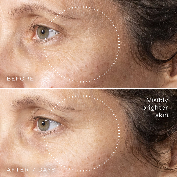 C-Tetra™ Advanced Gel-Serum-hover-6