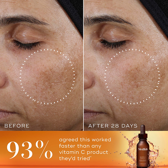 A side-by-side "Before" and "After 28 Days" comparison of a person's cheek and eye area. A white dashed circle highlights a reduction in the appearance of dark spots and uneven pigmentation in the "After" image. A bold orange banner at the bottom features the statement: "93% agreed this worked faster than any vitamin C product they'd tried*". The Super C Ferulic serum bottle is shown in the bottom right corner against a splashing amber liquid background.-hover-17