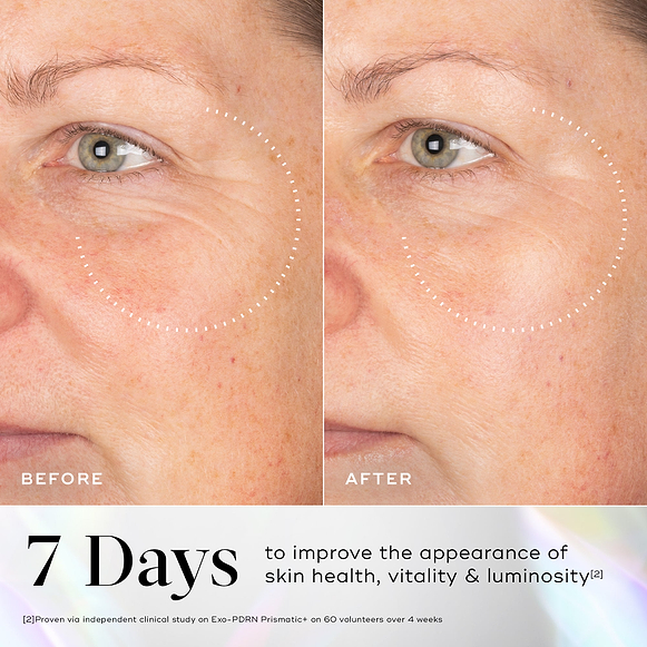 A before-and-after close-up of a participant's eye and cheek area, with dotted circles highlighting visibly smoother skin and reduced fine lines in the "AFTER" image. Text states "7 Days to improve the appearance of skin health, vitality & luminosity". A footnote references an independent clinical study on Exo-PDRN Prismatic+ on 60 volunteers over 4 weeks.-hover-2