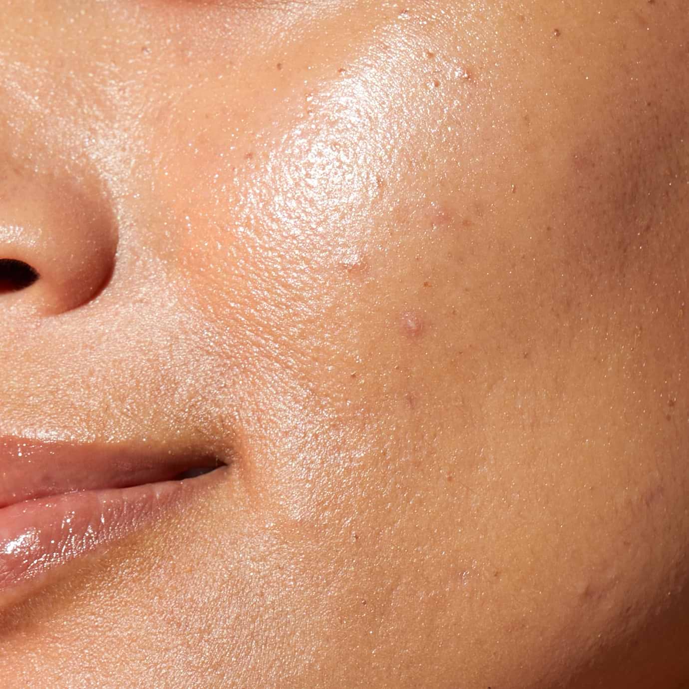 Skin Compounds Acids & Retinoids: How to Use Them in Your Skincare – Medik8