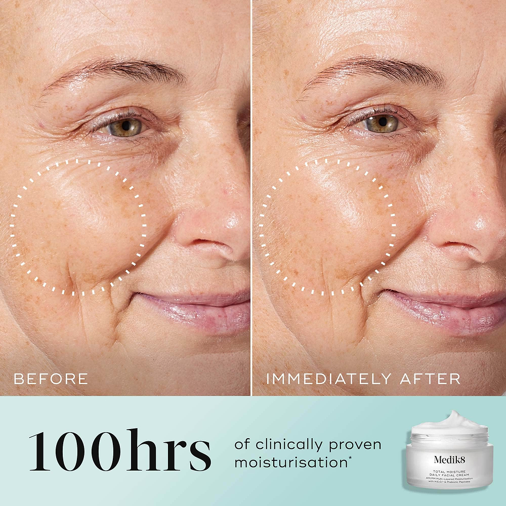 Total Moisture Daily Facial Cream™ (Travel Size)