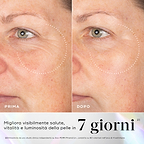Immagini prima e dopo della pelle che mostrano rughe visibili nel contorno occhi, con miglioramenti evidenziati dopo l'uso del siero Medik8 Exo-PDRN Prismatic+.