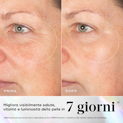 Immagini prima e dopo della pelle che mostrano rughe visibili nel contorno occhi, con miglioramenti evidenziati dopo l'uso del siero Medik8 Exo-PDRN Prismatic+.
