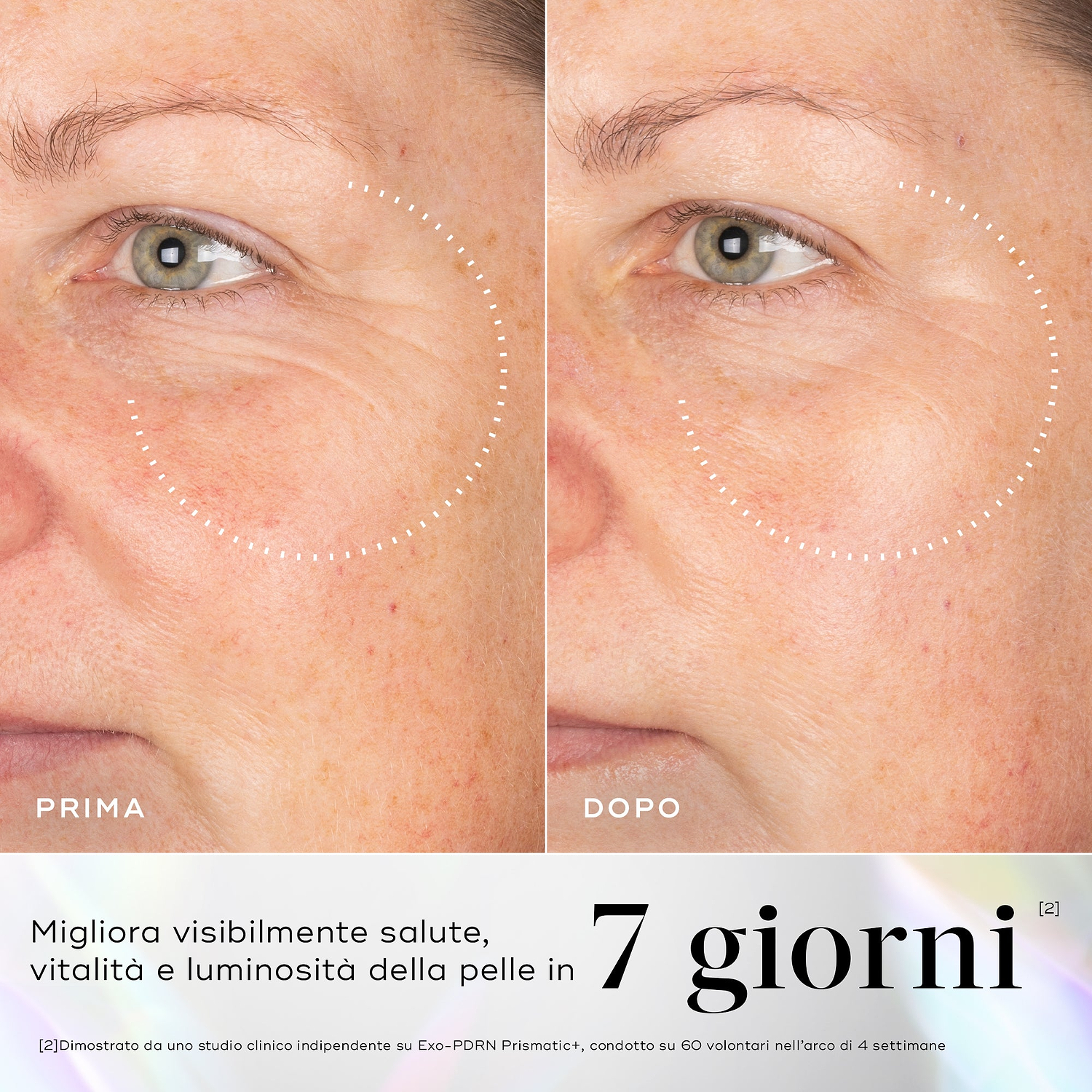 Immagini prima e dopo della pelle che mostrano rughe visibili nel contorno occhi, con miglioramenti evidenziati dopo l'uso del siero Medik8 Exo-PDRN Prismatic+.