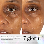 Immagini prima e dopo della pelle del contorno occhi che mostrano una migliore vitalità e luminosità cutanea dopo 7 giorni di utilizzo di Medik8 Exo-PDRN Prismatic+.