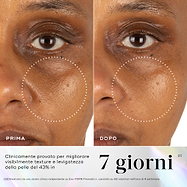 Immagini prima e dopo della pelle del contorno occhi che mostrano una migliore vitalità e luminosità cutanea dopo 7 giorni di utilizzo di Medik8 Exo-PDRN Prismatic+.