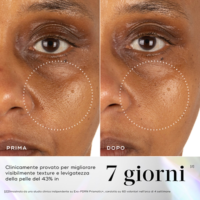 Immagini prima e dopo della pelle del contorno occhi che mostrano una migliore vitalità e luminosità cutanea dopo 7 giorni di utilizzo di Medik8 Exo-PDRN Prismatic+.
