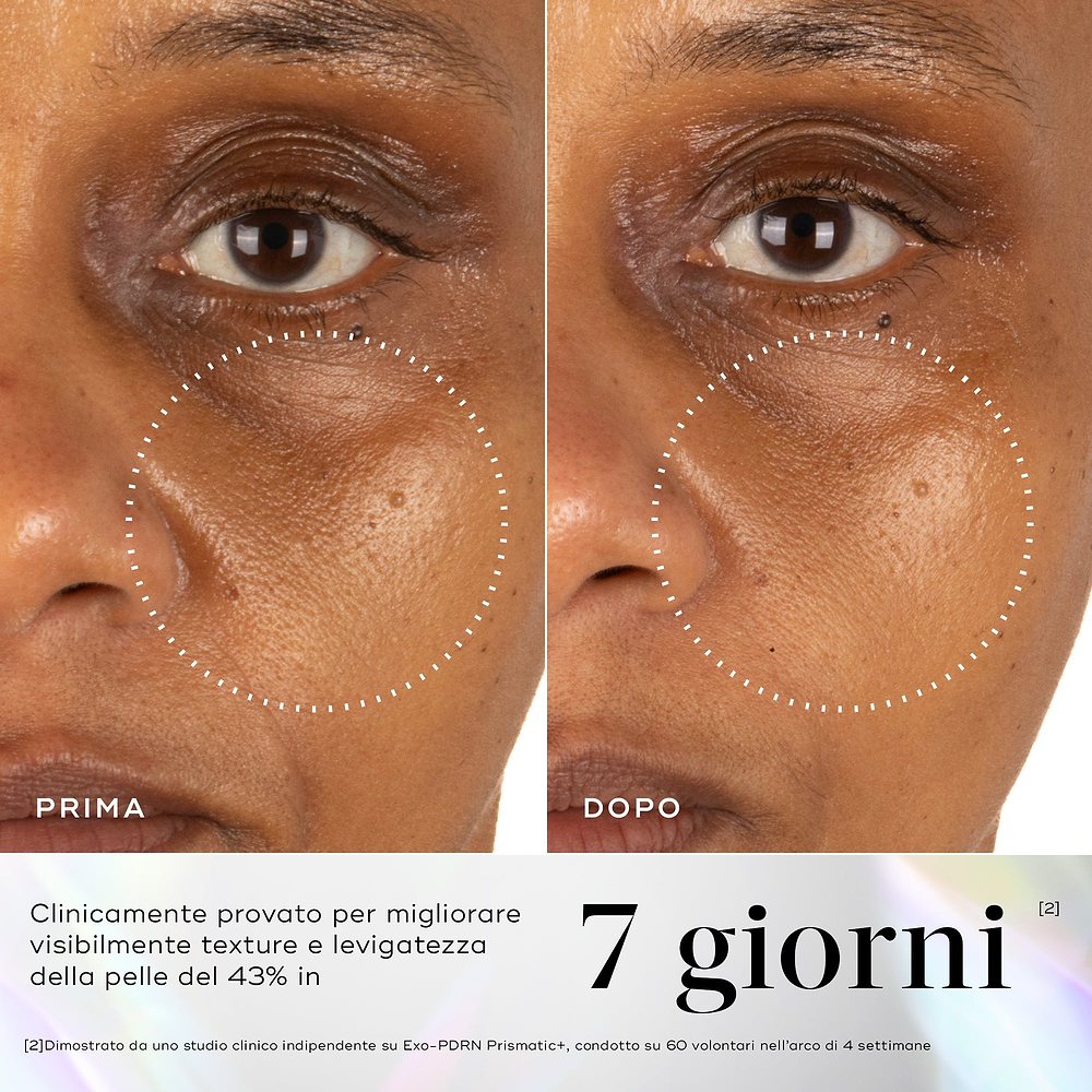 Immagini prima e dopo della pelle del contorno occhi che mostrano una migliore vitalità e luminosità cutanea dopo 7 giorni di utilizzo di Medik8 Exo-PDRN Prismatic+.