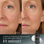 10 Min” – Confronto prima e dopo del viso di un partecipante mostrato accanto al flacone di Medik8 Liquid Peptides Advanced MP. Le immagini evidenziano la riduzione delle rughe intorno a occhi e bocca. Il testo sottolinea che il 100% dei partecipanti ha mostrato un miglioramento clinico delle rughe visibili in 10 minuti.