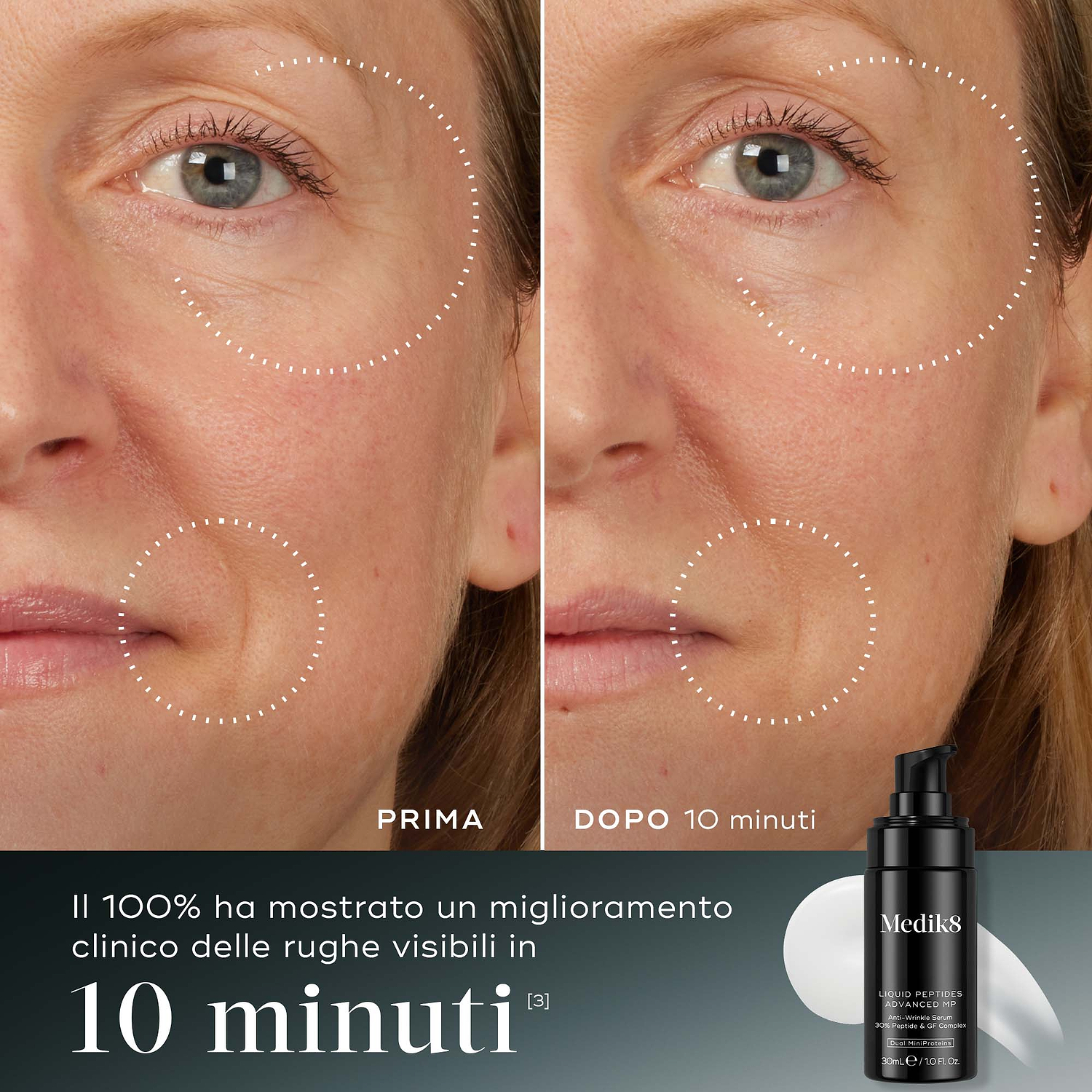 10 Min” – Confronto prima e dopo del viso di un partecipante mostrato accanto al flacone di Medik8 Liquid Peptides Advanced MP. Le immagini evidenziano la riduzione delle rughe intorno a occhi e bocca. Il testo sottolinea che il 100% dei partecipanti ha mostrato un miglioramento clinico delle rughe visibili in 10 minuti.