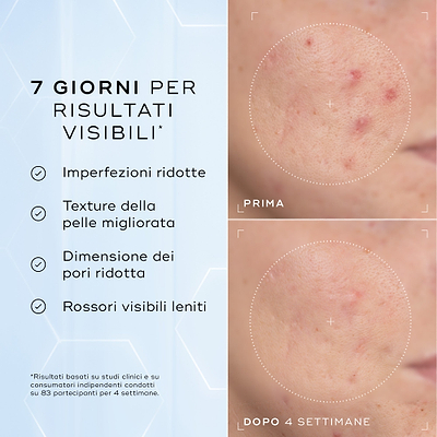 Niacinamide Peptides™