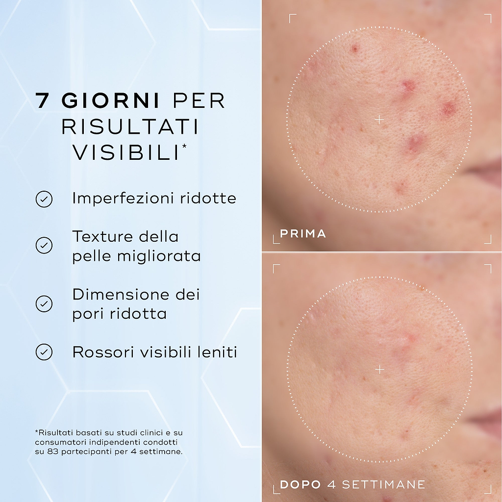 Niacinamide Peptides™