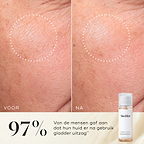 Voor- en na-close-up van de huid op de wang van een deelnemer, die een gladdere textuur en een egaler uiterlijk laat zien. De Medik8 Press & Glow tonicfles is in de hoek weergegeven. Tekst benadrukt dat 97% aangeeft dat hun huid er gladder uitzag na gebruik**.