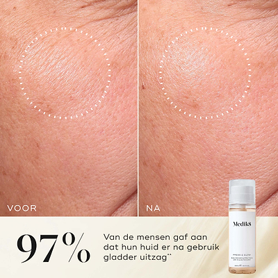 Voor- en na-close-up van de huid op de wang van een deelnemer, die een gladdere textuur en een egaler uiterlijk laat zien. De Medik8 Press & Glow tonicfles is in de hoek weergegeven. Tekst benadrukt dat 97% aangeeft dat hun huid er gladder uitzag na gebruik**.