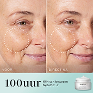 Een gesplitst scherm met een voor- en na-vergelijking van het wang- en ooggebied van een vrouw, waarbij een gestippelde cirkel in de “DIRECT NA”-afbeelding zichtbaar vollere huid en verminderde rimpels benadrukt. Tekst vermeldt “100 uur klinisch bewezen hydratatie*” naast een afbeelding van de Medik8 Total Moisture-pot.