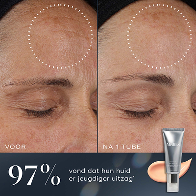 Een voor-en-na vergelijking van het voorhoofd van een deelnemer toont zichtbaar verbeterde huid na één tube Medik8 Crystal Retinal. De tekst vermeldt dat 97% van de mensen vond dat hun huid een jongere uitstraling had.