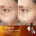 Voor- en na-vergelijking van de huid van een deelnemer over 7 dagen, waarbij zichtbaar helderdere huid met verbeterde uitstraling en een egalere teint wordt getoond.
Voor- en na-close-up van de huid van een deelnemer over 7 dagen, die een zichtbaar gladdere huidtextuur en verfijnde uitstraling laat zien.